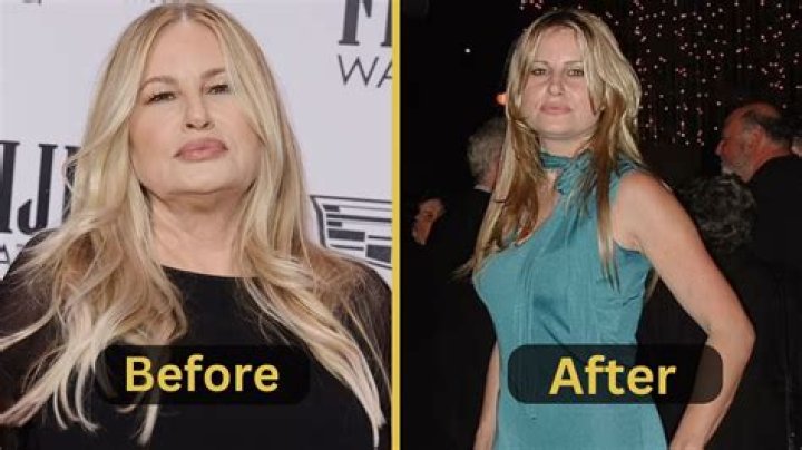 Jennifer Lawrence Weight Loss: Before & After!